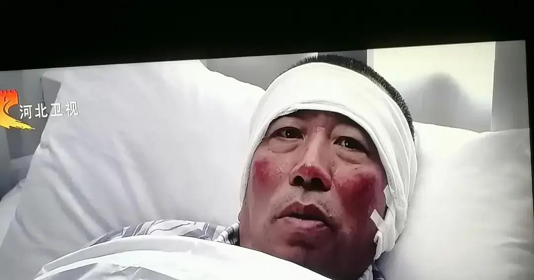 张嘉译和小宋佳演的《悬崖》被很多人捧为国产谍战天花板，我前前后后也反复看了好几遍，但剧里有两个极其扎眼的硬伤，每次重温都觉得如鲠在喉

先说顾秋妍跳崖那场重头戏，大雪天里她紧急发报，镜头给得清清楚楚，她根本就没戴手套，两只光手在机器上噼里啪啦一顿敲。后来机器连着那个咖啡色旧皮箱被特务头子高彬缴获，高