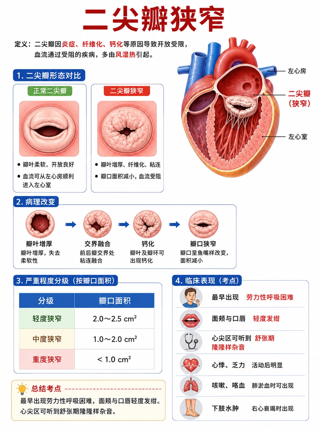 阿虎医考笔记：二尖瓣狭窄VS二尖瓣关闭不全