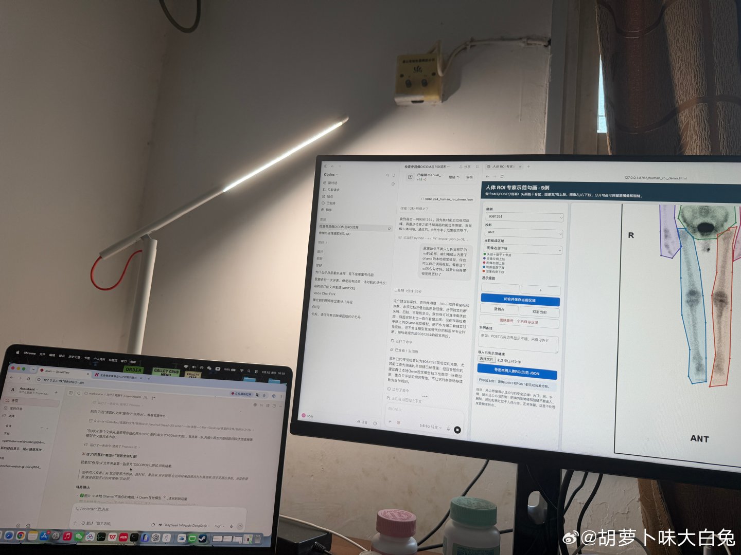 左手openclaw，右手codex 5.6sol，内置的还有ollama，电脑99摄氏度的日常，简直神仙打架，影像组学之神机。 ​