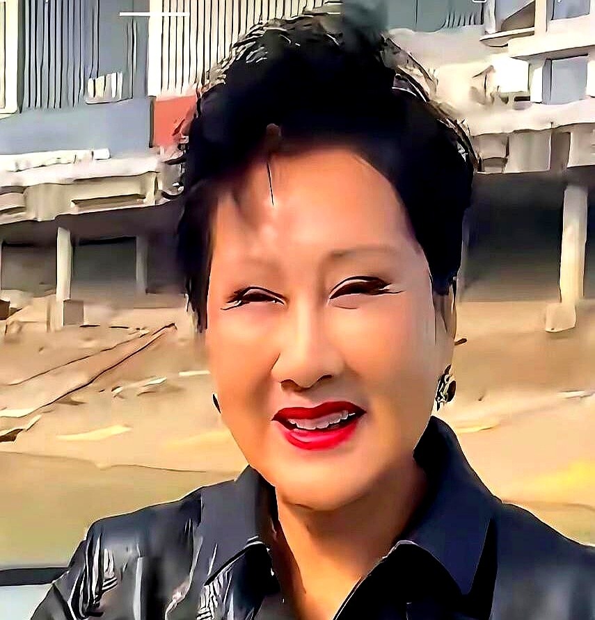 张靓颖大大方方承认自己医美过度的时候，反倒没人揪着不放了。

最近张凯丽出镜，脸部状态又成了网友茶余饭后的谈资。镜头太苛刻，哪怕有一丝不自然，都会被高清画面放大。

圈里不少人把动脸当成职业需要。为了上镜好看，拼命折腾。结果脸僵了，表情做不出来，反倒连本职工作都受影响。

谁都想留住青春。

但比起