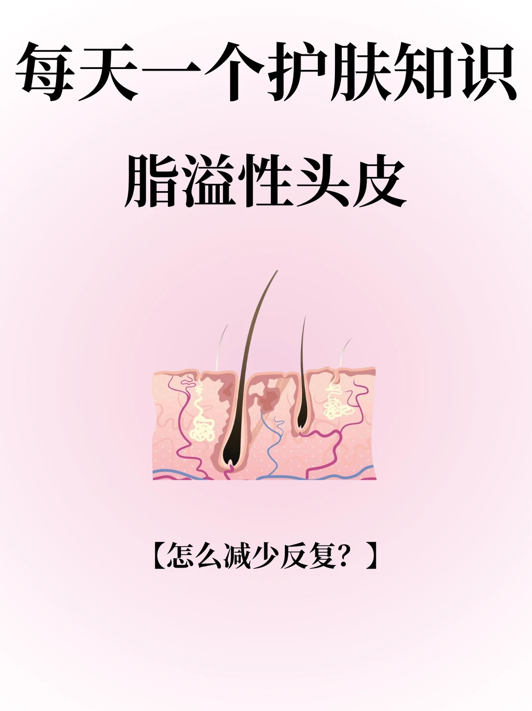 每天一个护肤知识：脂头