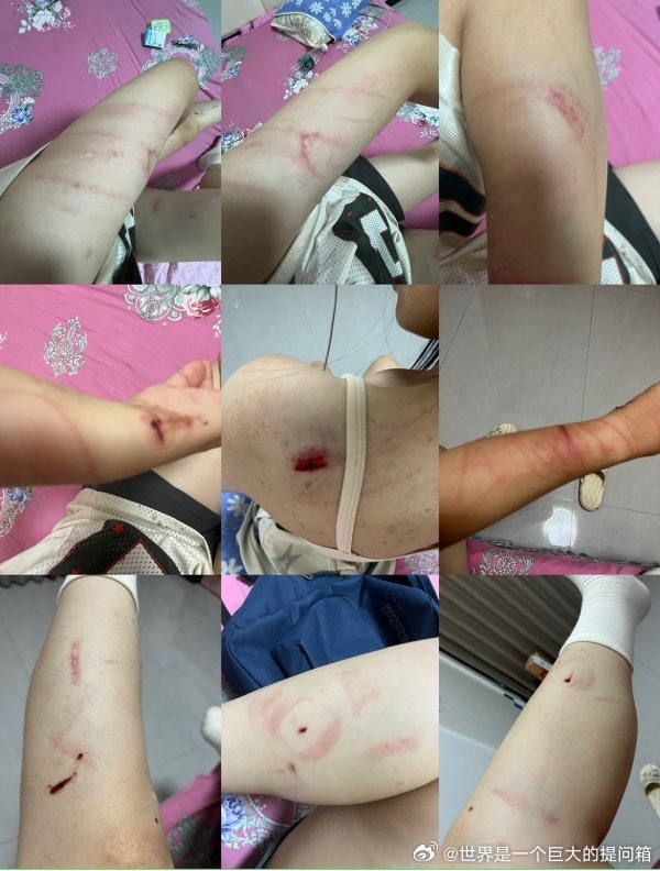 你们好 我想问问你们会怎么选择 我是一个高一升高二的女孩。我从小在甘肃长大，和奶奶、姐姐一起生活。我父母在我很小的时候就离婚了，他们都各自组建了新的家庭。我爸爸那边，还有一个后妈和继姐。初一那年，我爸说要把我接到陕西，说是为了更好的教育——后来我才知道，他是为了掏空奶奶的养老金，在 ​