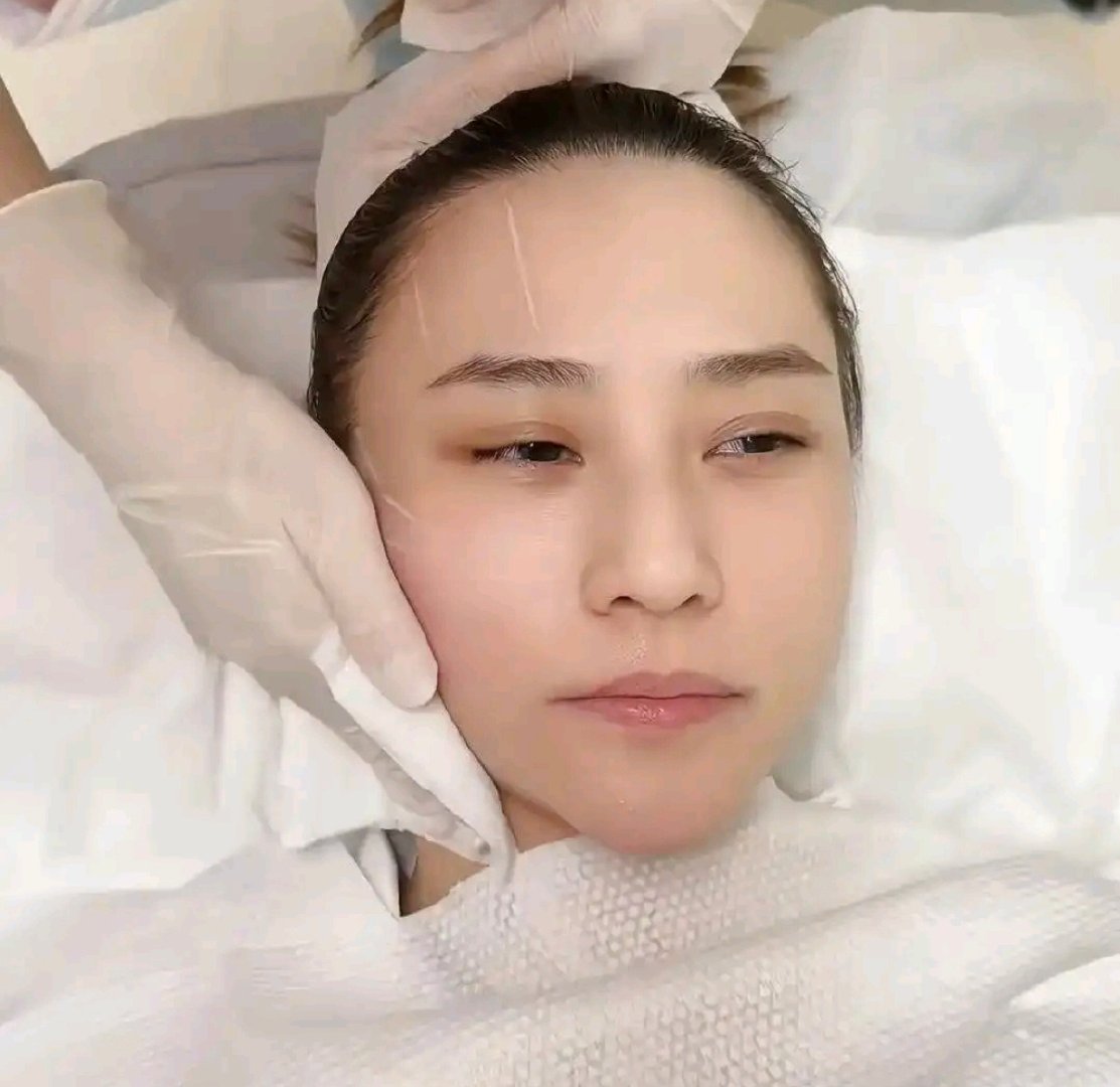 35岁何超莲素颜直接硬扛无麻医美，疼得牙都酸了，做完转头就约了下一次，说这跟交房租得定期交，网友看傻：百亿千金也逃不过给脸打工。 ​