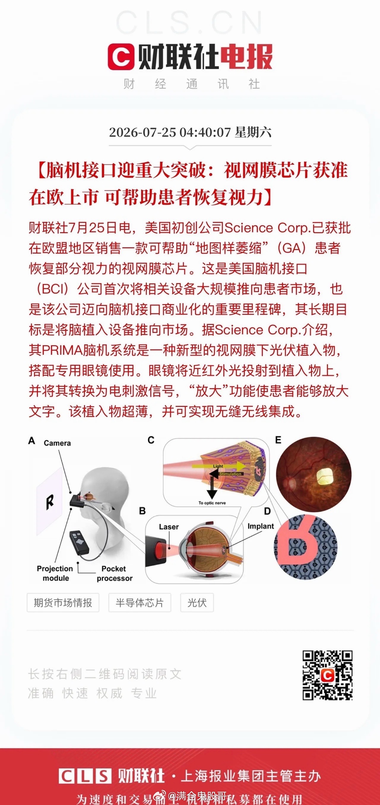 脑机接口技术落地提速，科幻场景正式照进现实  近期中美两国在脑机接口前...