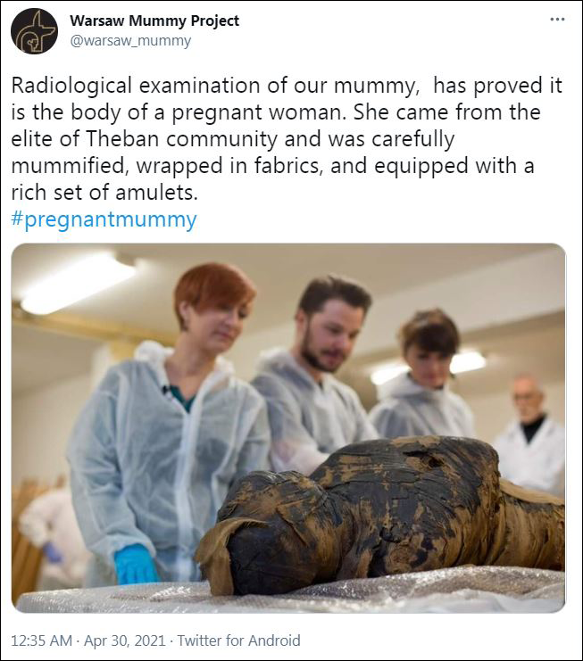 波蘭研究人員宣佈發現世界首具懷孕木乃伊-圖2