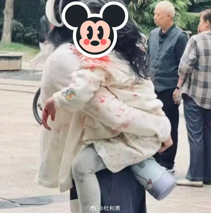 #恶犬再闯大祸孩子受伤严重#【法律已“长牙”为何恶犬仍在伤人？】9月12日，四川眉山一小区内，一只未拴绳的大型犬扑向3岁女童，致其面部、颈部多处严重撕裂，父亲与三名施救者亦被咬伤。狗主人已被刑拘，但孩子脸上可能伴随一生的疤痕，谁来抚平？

“我家狗不咬人”——这句被无数养犬人挂在嘴边的话 ​