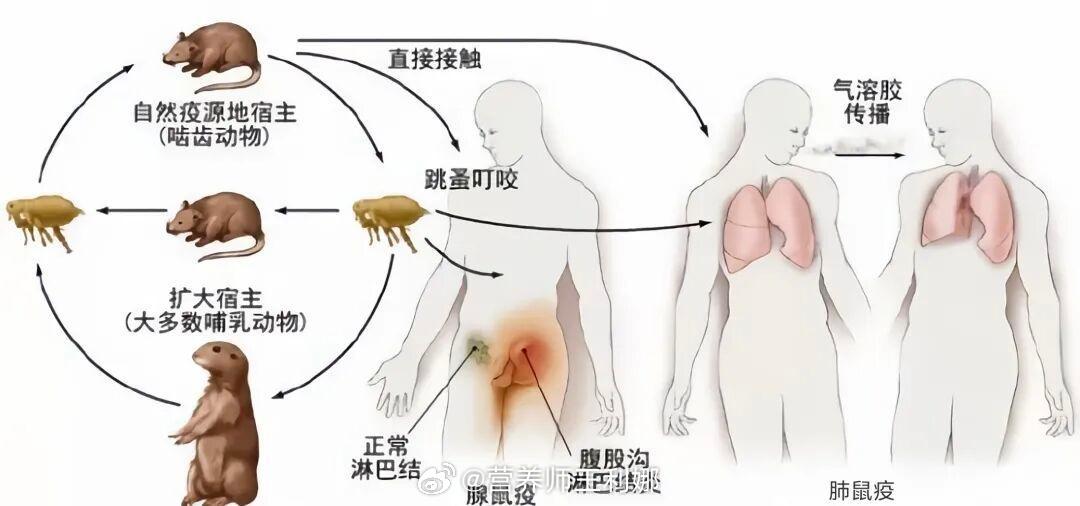 #内蒙古呼伦贝尔发布鼠疫风险提示##健闻登顶计划# 
鼠疫是由鼠疫耶尔森菌引起的甲类传染病，俗称“一号病”。它具有发病急、传染性强、传播速度快、病死率高的特点。
主要通过跳蚤叮咬、接触染疫动物、呼吸道飞沫等途径传播。潜伏期1-6天，多数2-3天，最长可达8-9天。突发39-41℃高热寒战、剧烈头痛、 ​