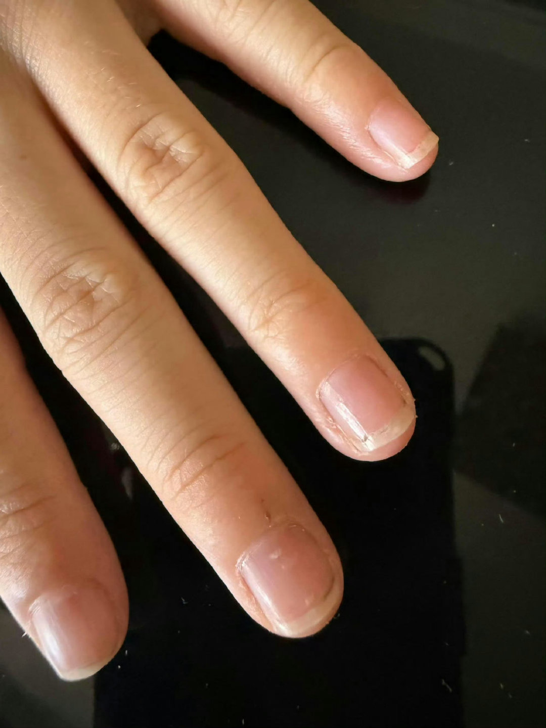 同意买狗害了孩子，每每想起好自责 ​
