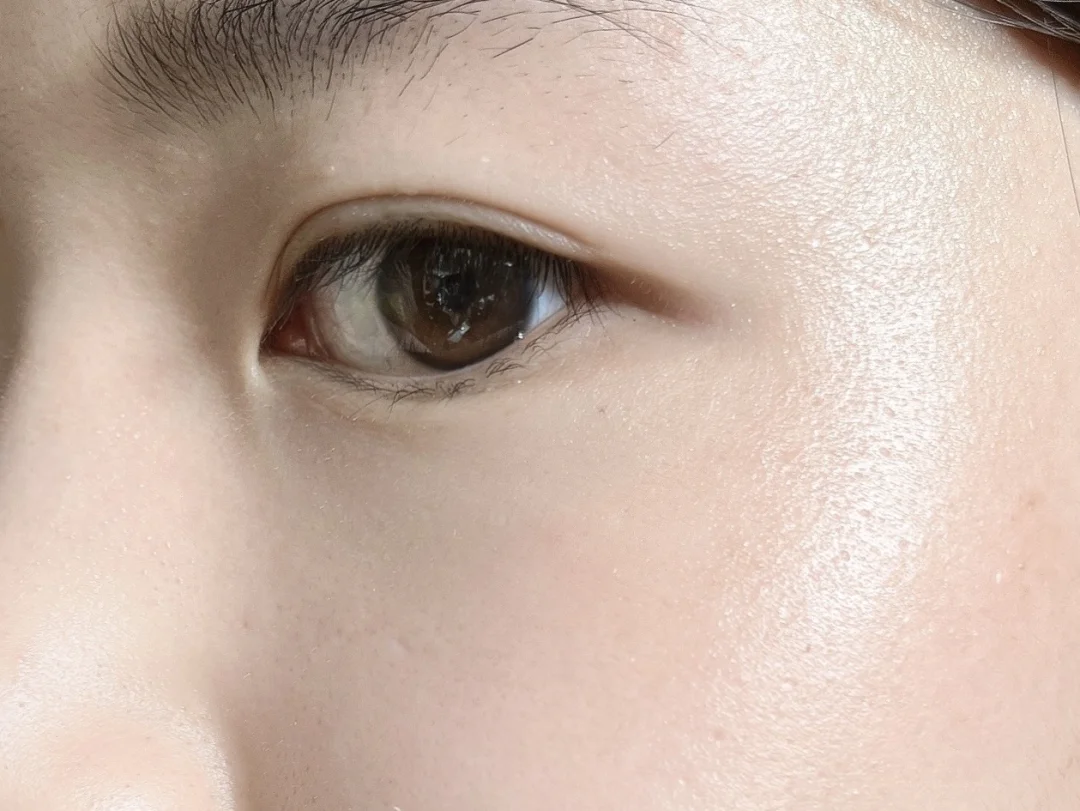 韩国买的眼袋闭合剂好用死了啊啊啊啊啊啊