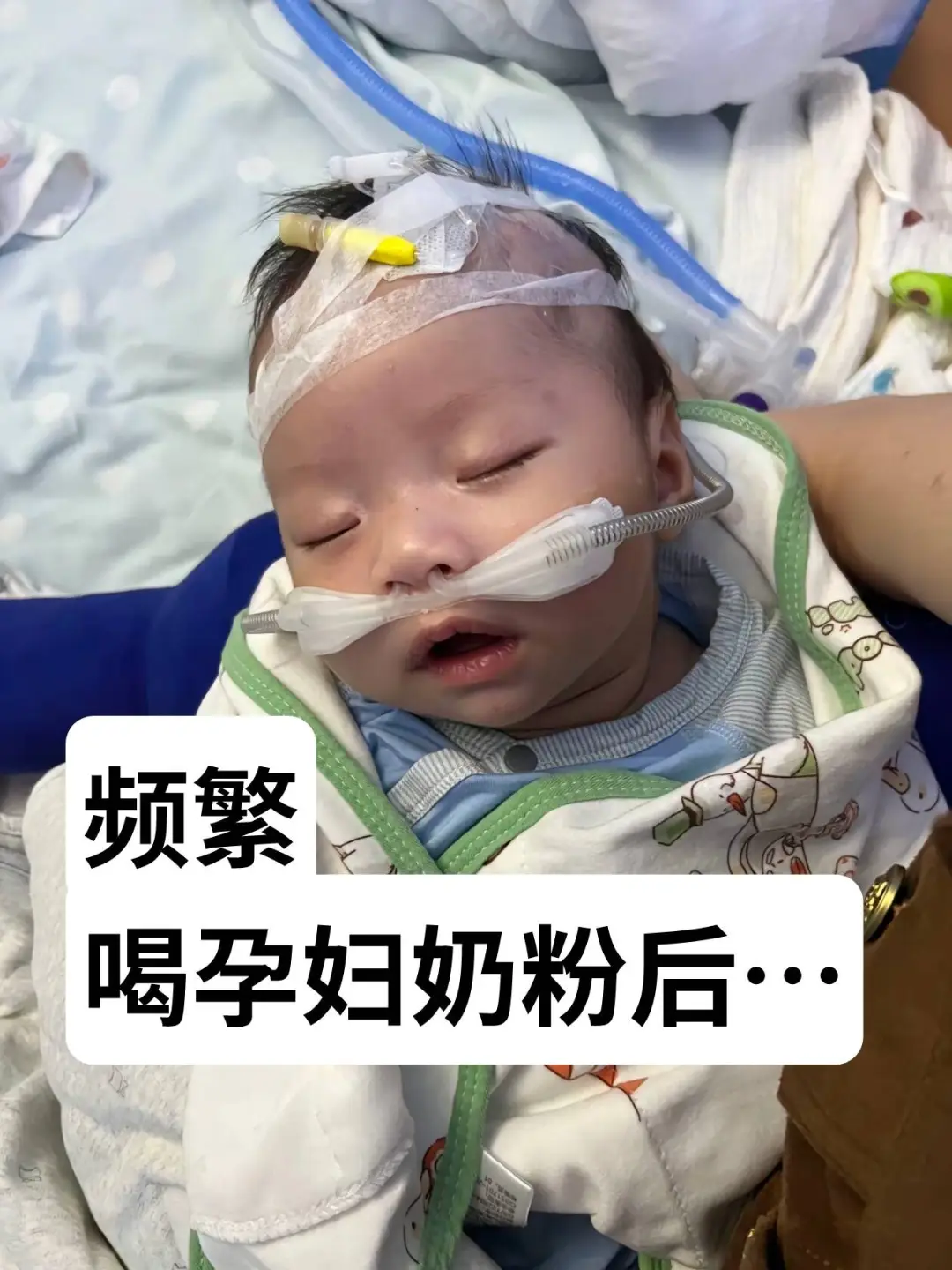 胎儿偏小，喝完孕妇奶粉的滞后性好可怕。。