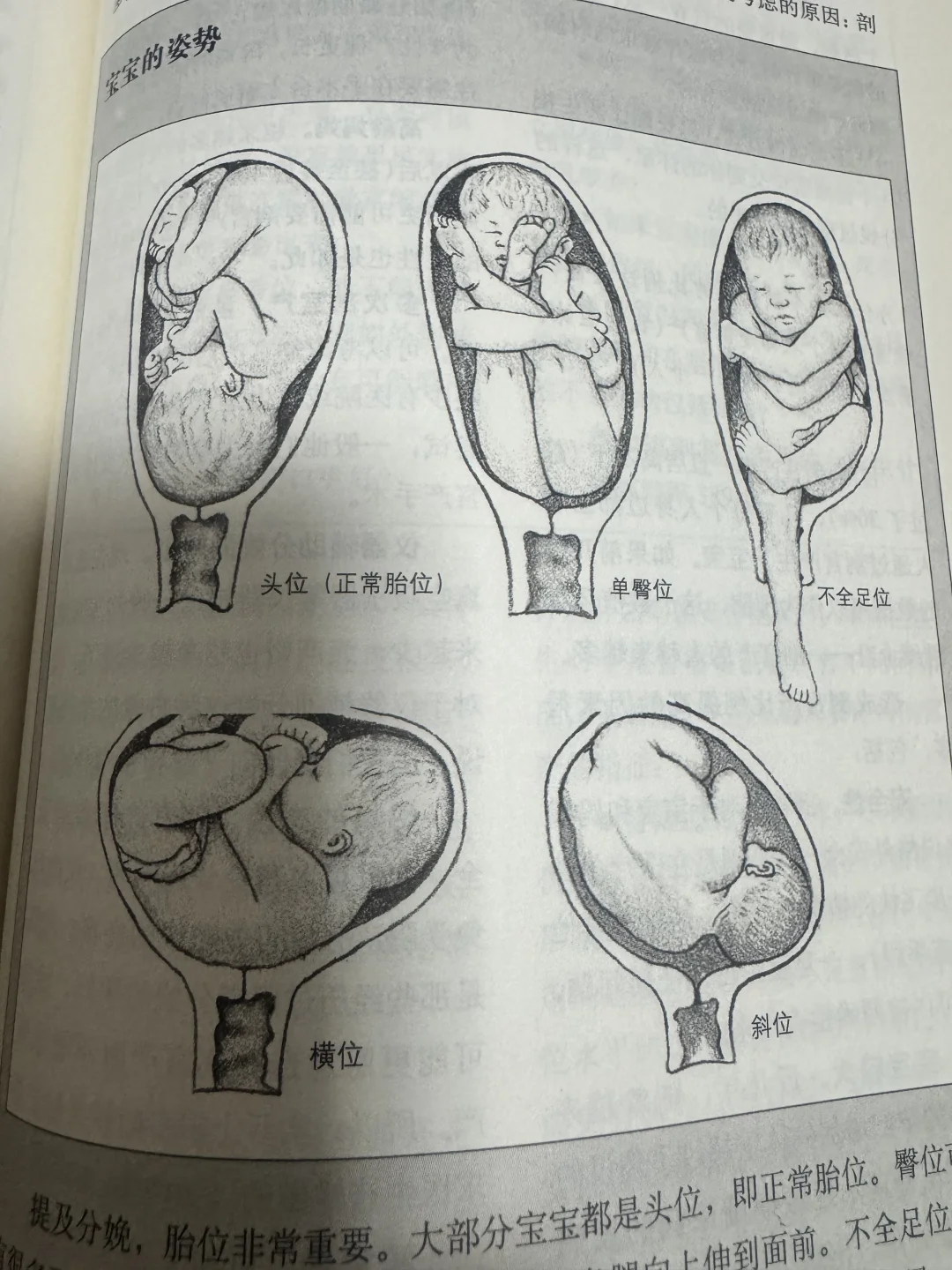 不用纠结顺产还是剖腹产，做好准备才是关键