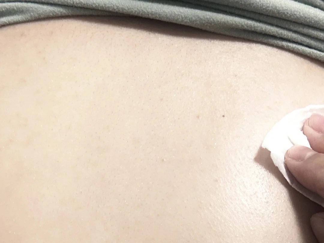 前胸后背长痘的都去山姆买这个！！！！！！！