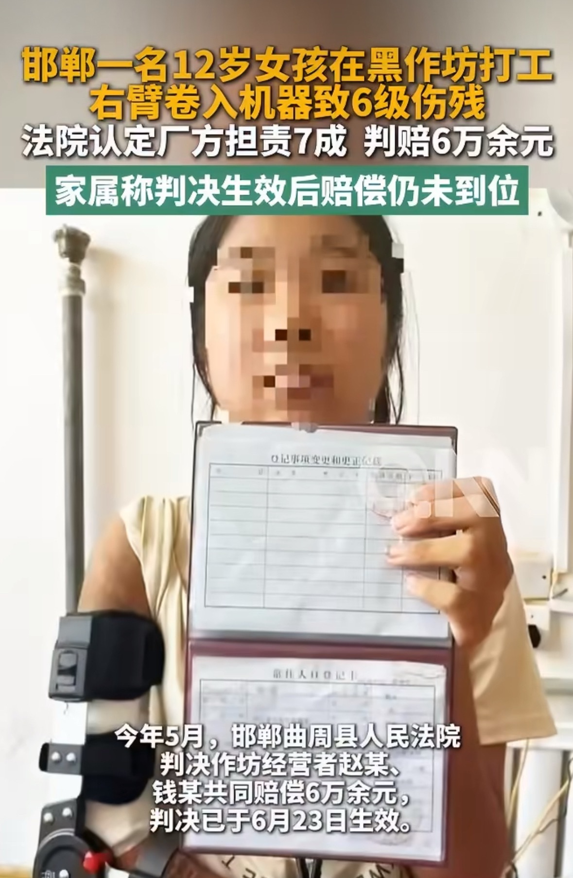 #12岁女孩打工致残父亲发声# 本该坐在教室的12岁女孩，在黑作坊打工酿成悲剧，六级伤残的伤痛伴随一生。父亲出面求助，判决已经下来，赔偿却迟迟不到位。非法雇佣童工的代价，不该让一个孩子独自承担。

入职仅13天就遭遇意外，12岁女孩落下六级伤残。父亲发声，涉事作坊拒不履行赔偿。黑作坊违法招用 ​