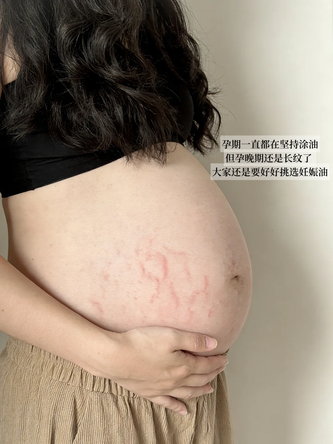 选错妊娠油结果长纹了！新手孕妈别再瞎买啦