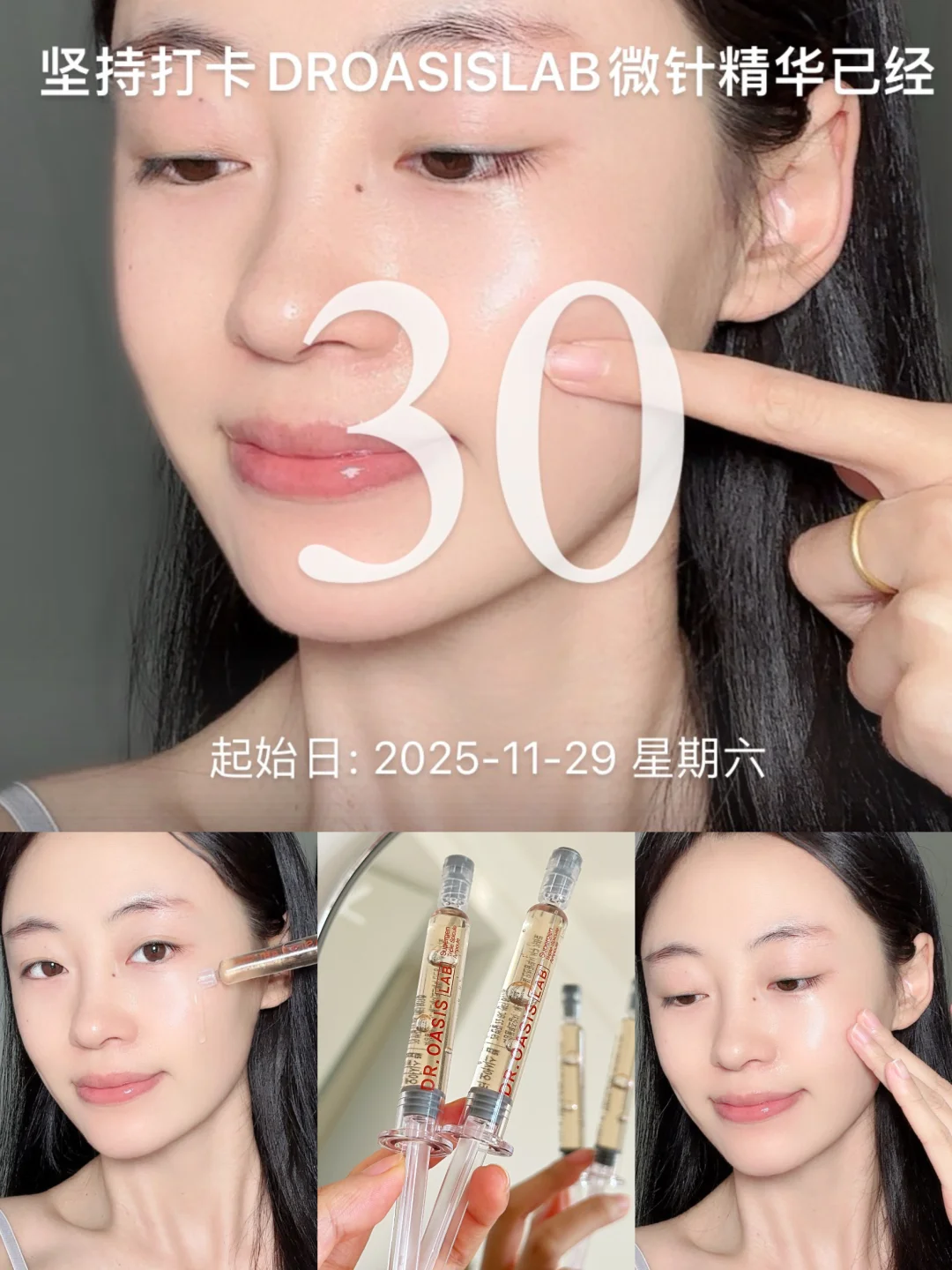 居家“微针水光”28天我换了一张紧致脸