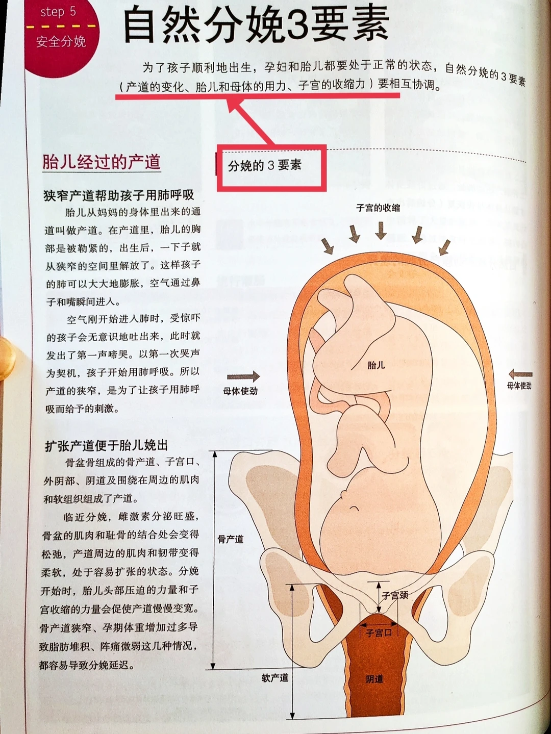 🔥接顺产无侧切无撕裂！无痛分娩vs剖腹产