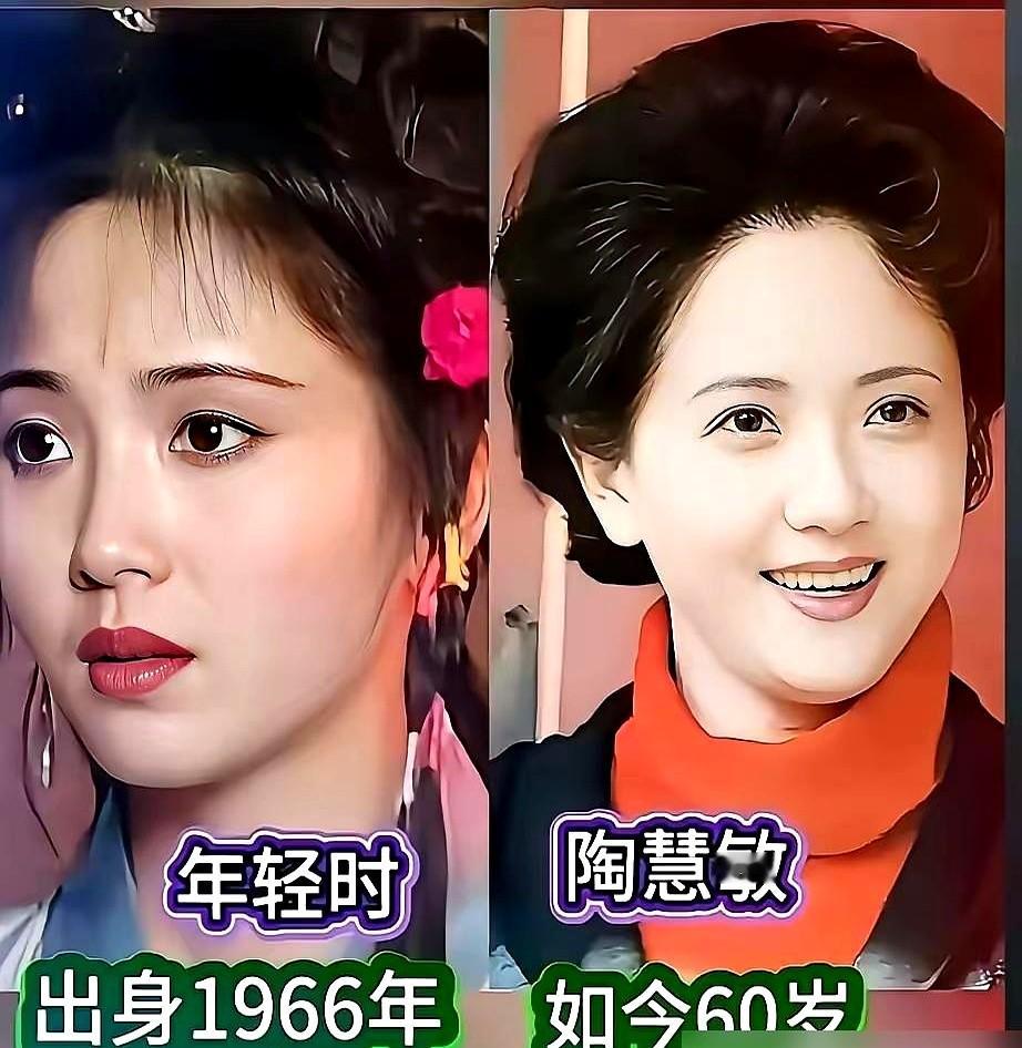 “导演嘴上说不要，身体却很诚实。”宁静一句话，把圈子里那点潜规则捅破了。

何赛飞也忍不住吐槽，说现在这审美，全是资本在喂，流水线下来的“白瘦幼”。上次碰到个同行，愣是没认出来，脸变太多了。

她自己也试过去皱针，又贵又疼，打了一次就怕了，决定还是让皱纹自己长吧。可年轻演员没得选，不去“微调”一下，