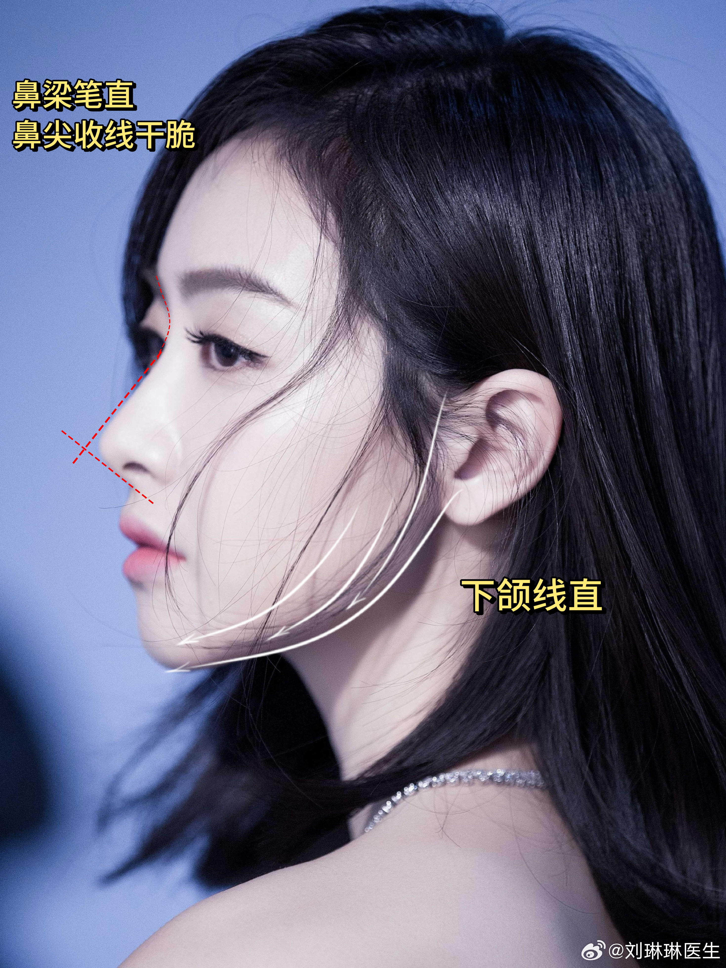 原来f(x)已经成立十七周年了🎉，宋茜直播庆祝，梦回Victoria时期，当年一身红衣舞台直接霸榜南韩热搜多日。（图1）

究竟为什么她可以红火这么多年？除了超强的舞台表现力，这张抗住各种镜头、越品越耐看的脸，同样功不可没。

【轮廓骨相】（图2）
宋茜是标准的长鹅蛋脸，整体脸型线条圆润流畅、长 ​