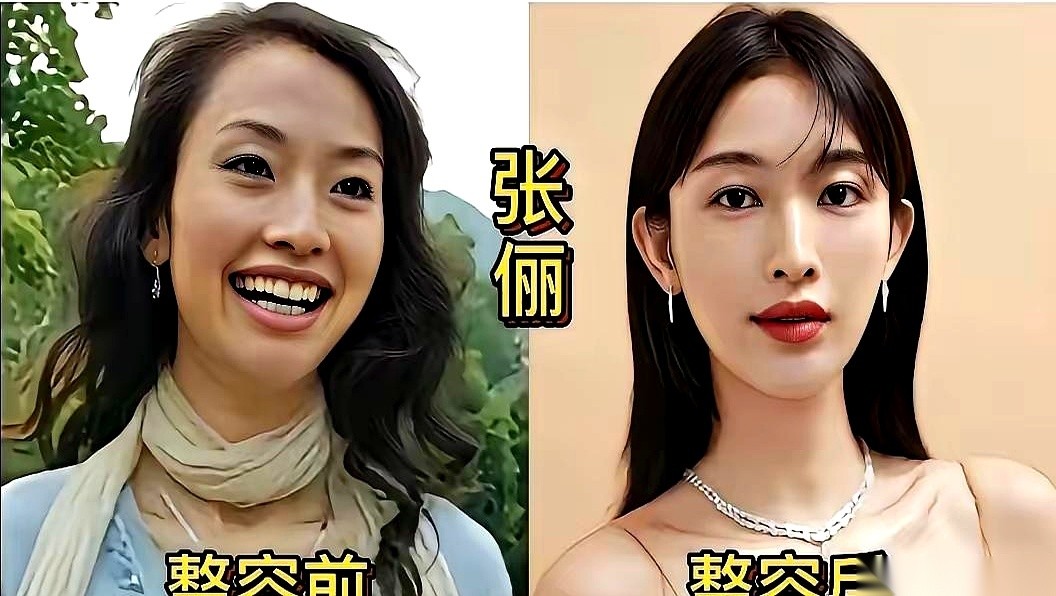 熊黛林以前的模样和现在的长相差得挺多。
谢楠也是被不少人指出来比早前更精致漂亮。
但这变动到底能在事业和情感上换来多少实际结果，至今没人能列出明细。
很多人嘴上常说，现在环境早就不一样了，大家见得多了，心里根本用不着背什么负担。爱好看的脸是人的本能，只要能在台面上走得更顺、在日子里把感情抓牢，旁人犯