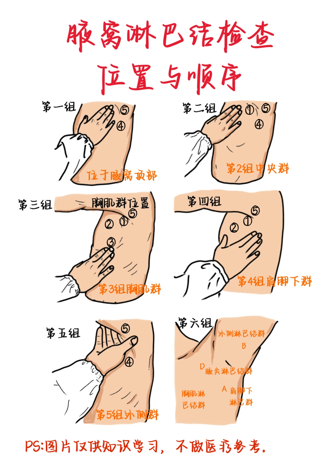 医学生笔记——腋窝淋巴结检查位置与顺序