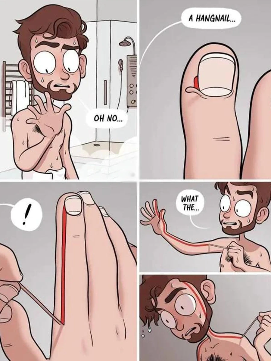 倒刺，是指甲周围的皮肤在向你哭诉💔