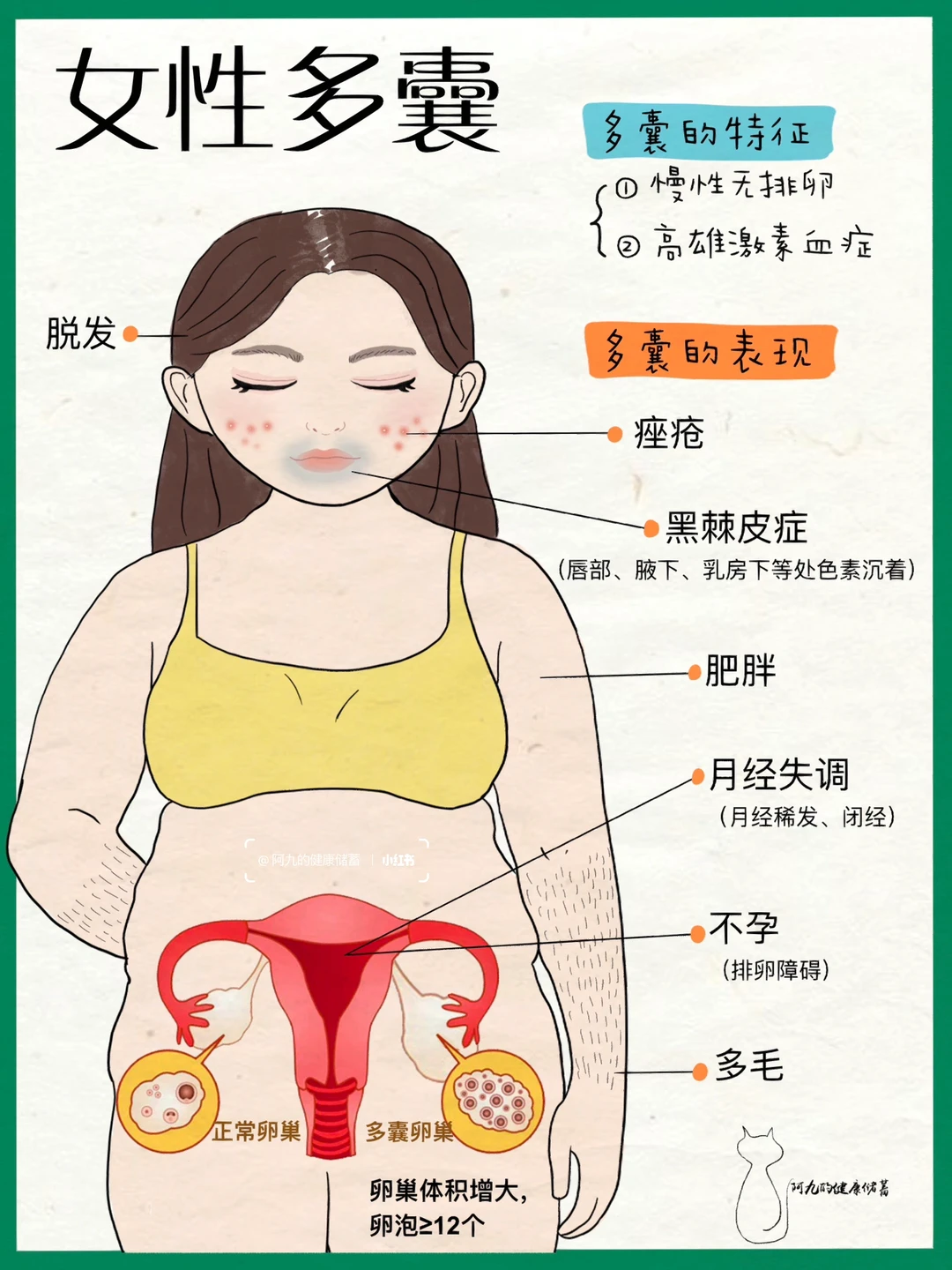 女性多囊不用怕｜一篇全搞定