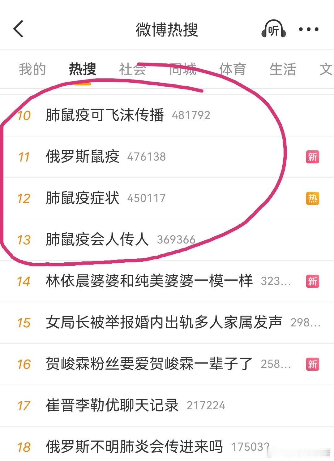 #俄罗斯不明肺炎会传进来吗#大家都在关注鼠疫…担忧的重点是会传过来吗？都怕了！ ​