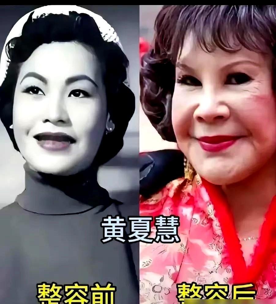 舒畅发自拍硬撑“状态挺好”，评论区却都在叹气。

38岁参加活动生图僵硬得像戴了面具，越解释越尴尬。不止是她，赵露思站台时山根突起、鼻翼收窄；Lisa在巴黎时装周一笑也僵；梅根·福克斯在外网更是直接被问“这是谁”。

都在拼命追求极致，反倒亲手扔了老天赏的辨识度，全成了一个模子刻出来的假人。脸是这样