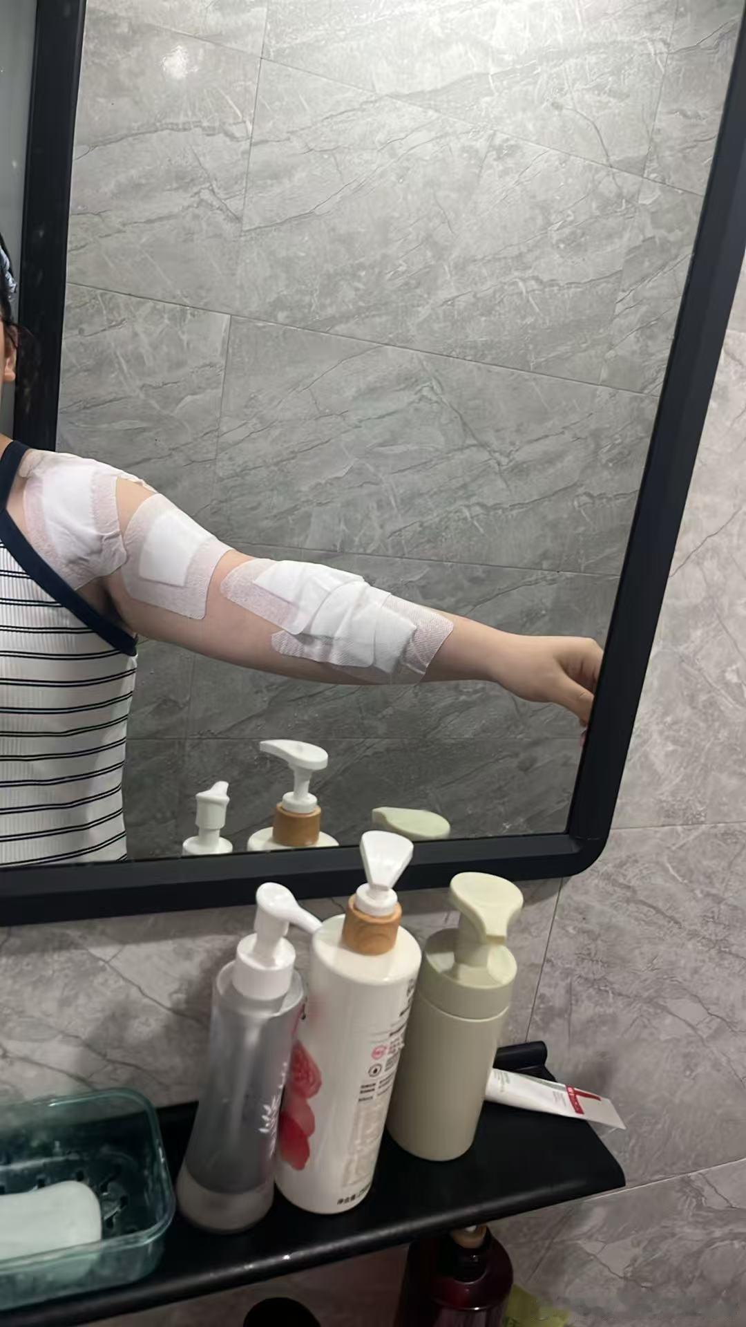 生活你就这样对待我……
     打算给排骨炒一个糖色的时候，锅里的油就奋起直击我，冲了一个半小时的凉水，还是非常痛，直接打车去医院了。但是去医院的路上又不痛了感觉又好了。但是秉承着来都来了，在医院包扎了一下伤口，医生说不是很严重，让我后天再去换药。
   从医院出来，老十三被我在地上摔了 ​