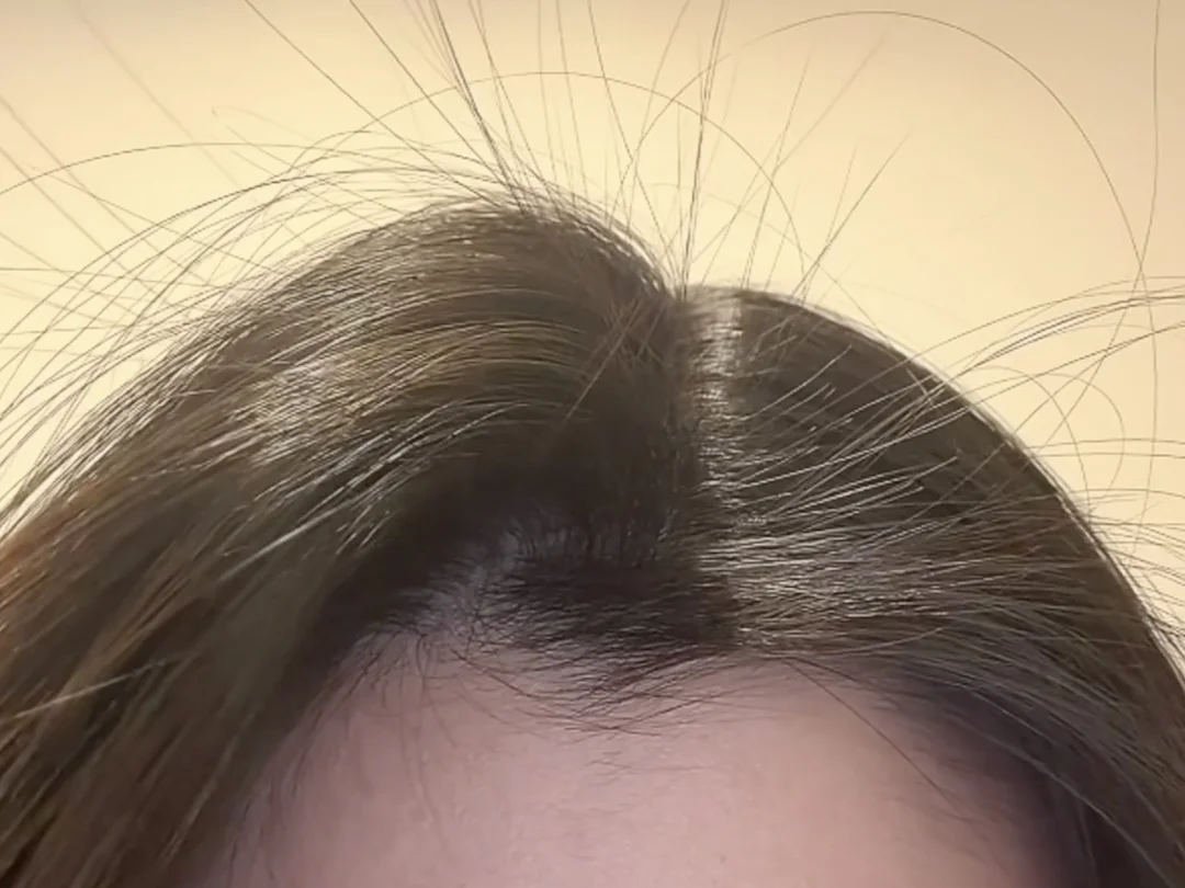 强推一个韩国的发缝闭合剂