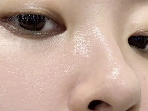强推一个韩国的汗管粒脱落剂