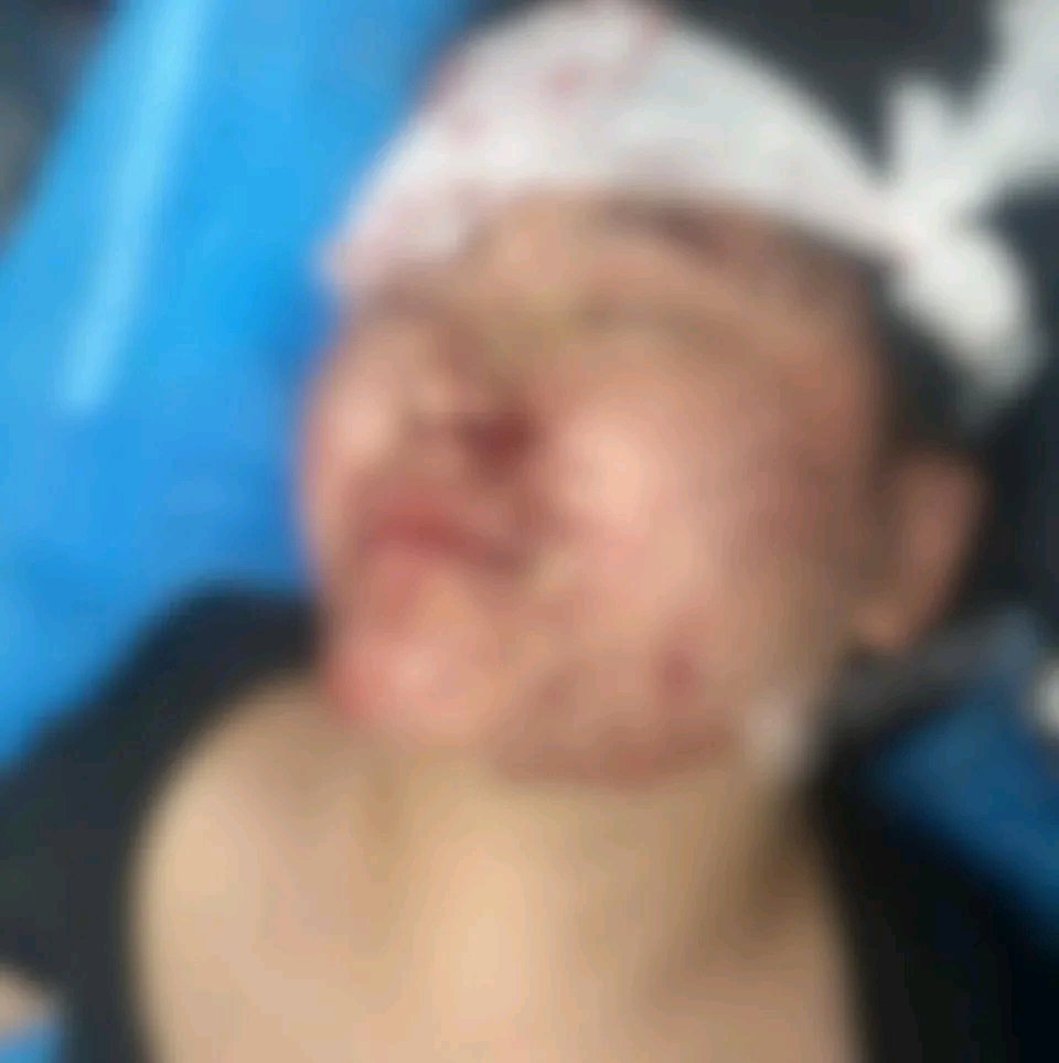 郑州30岁的丁女士真是给大家敲响了警钟。那天晚上下雨，她边骑电车边玩手机，结果一头撞上栏杆，直接昏迷，地上全是血。她在ICU抢救2天，住院10天，额头缝了好几针，差点毁容。
《郑州市非机动车管理办法》早有规定，骑车时不能手持拨打电话、浏览电子设备，可很多人都不当回事。其实，3秒“盲骑”就可能出事，雨