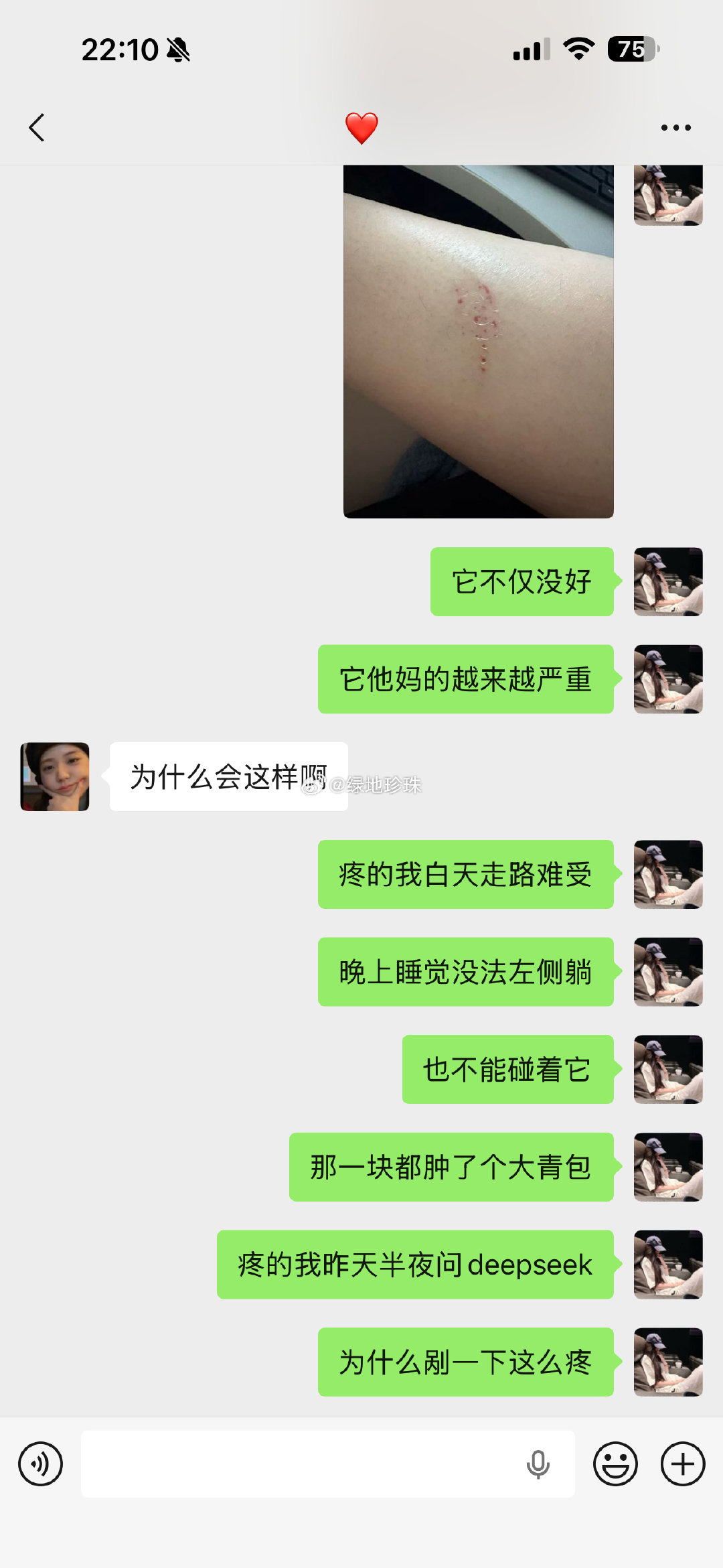我真的有点心碎 ​