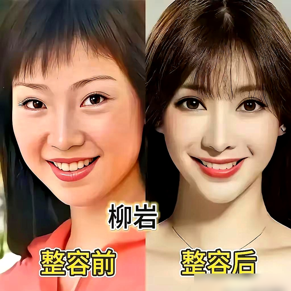 沈梦辰承认整容了，还承认得特别理直气壮。
早年间她什么样？黑黄皮，脸宽，下巴圆，鼻子塌。放人群里也就是个清秀。现在呢？冷白皮，头包脸，鼻梁拔地而起，站浪姐舞台上跟换了个人似的。
搁以前，整容是黑料，艺人被问到这个恨不得当场否认三连。她倒好，上综艺直接说丝毫不介意被说是整容脸，因为这是在变相夸我美