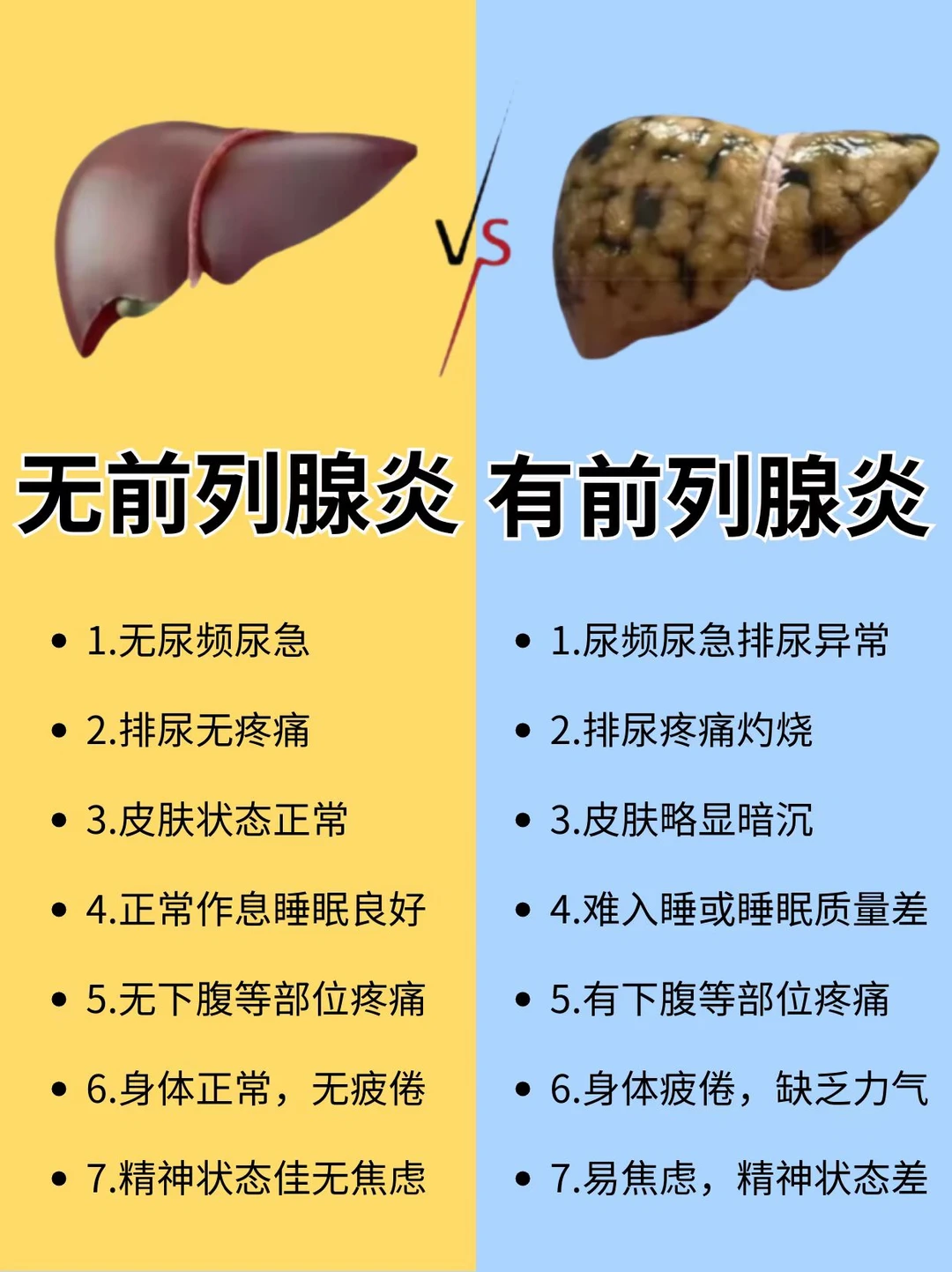 速来看有无前列腺炎! 教你如何分辨
