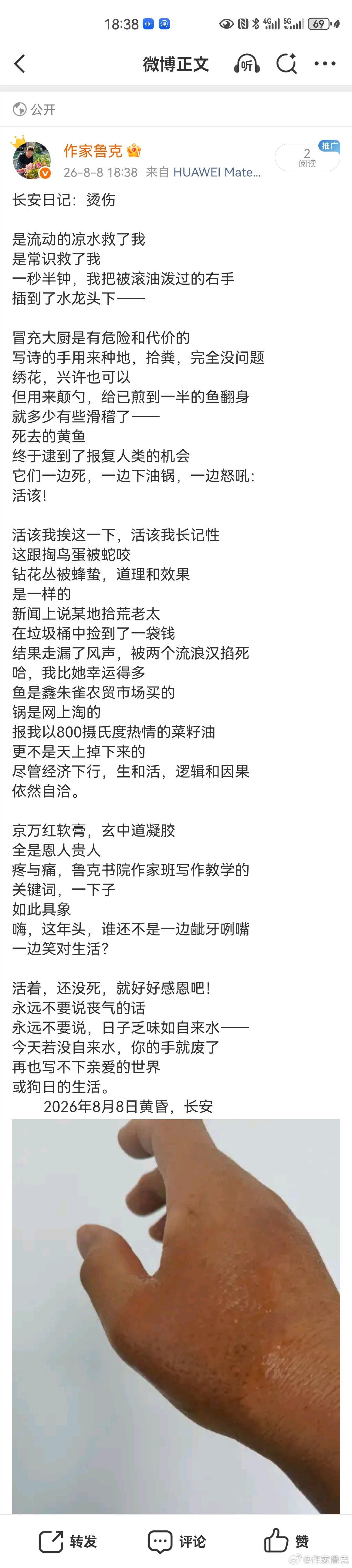 元宝深度解读鲁克《长安日记：烫伤》  这首诗是鲁克“长安日记”系列里把...