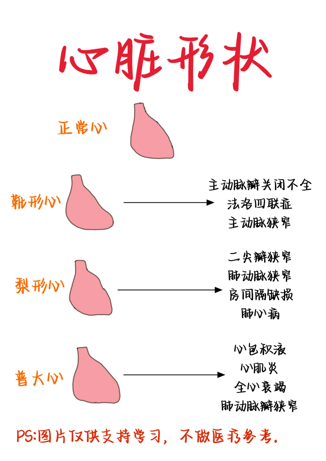 医学生笔记——心脏形状