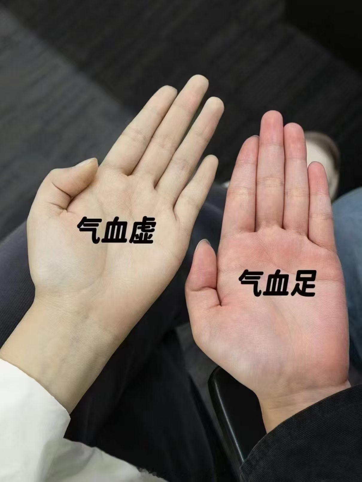 科学吗？那我气血太足了，但很虚呀，动两下就累，出门一趟就感觉耗尽所有气力。 ​​​