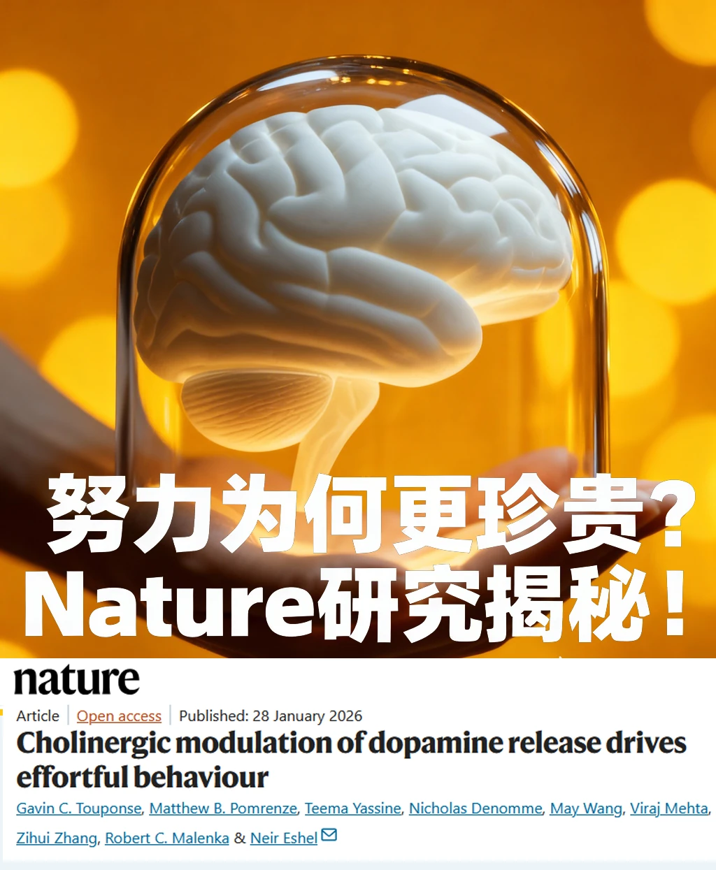 Nature重磅-为何越难得到的越渴望