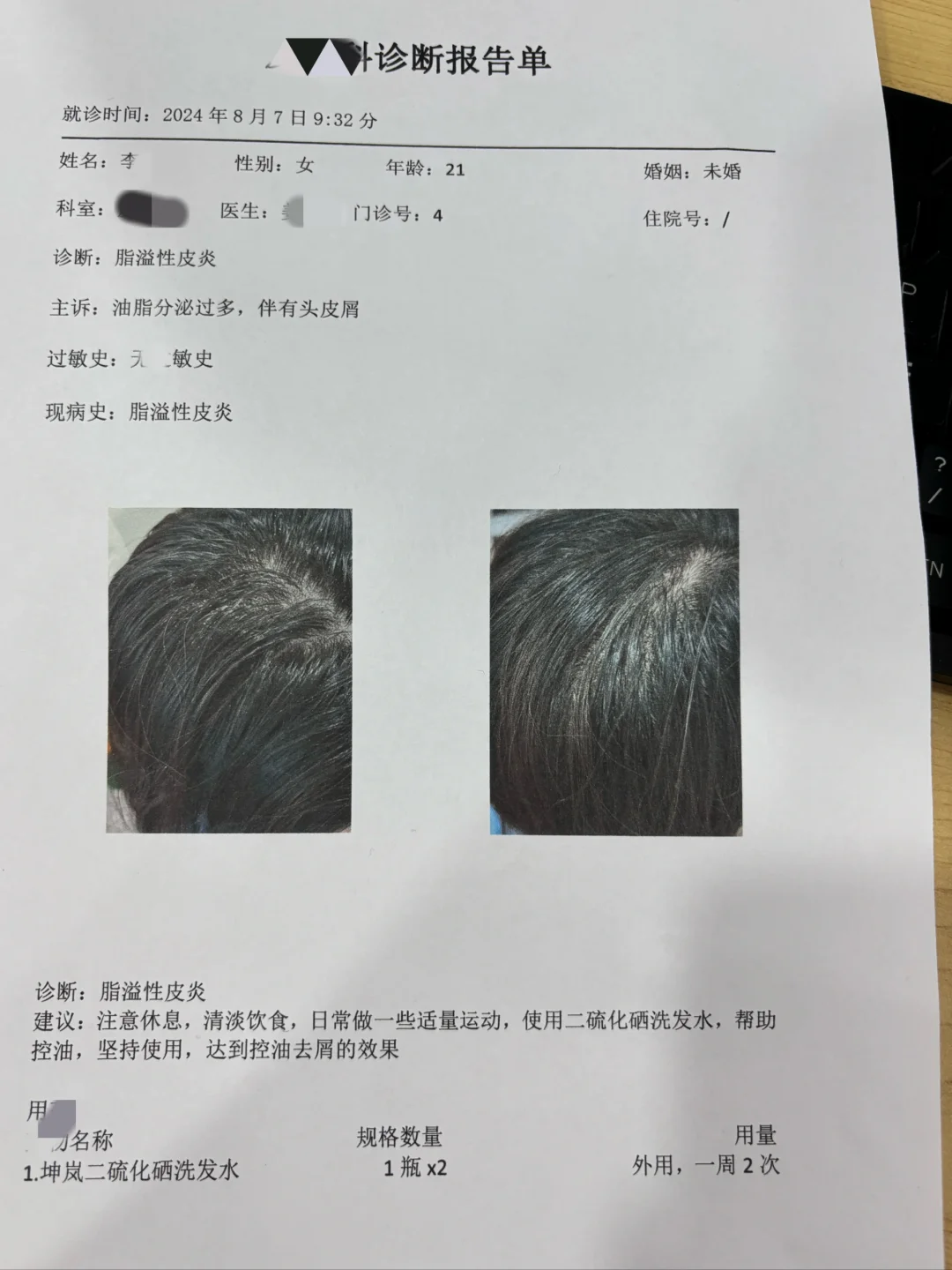 去了皮肤科才知道脂溢性皮炎是因为不爱干净