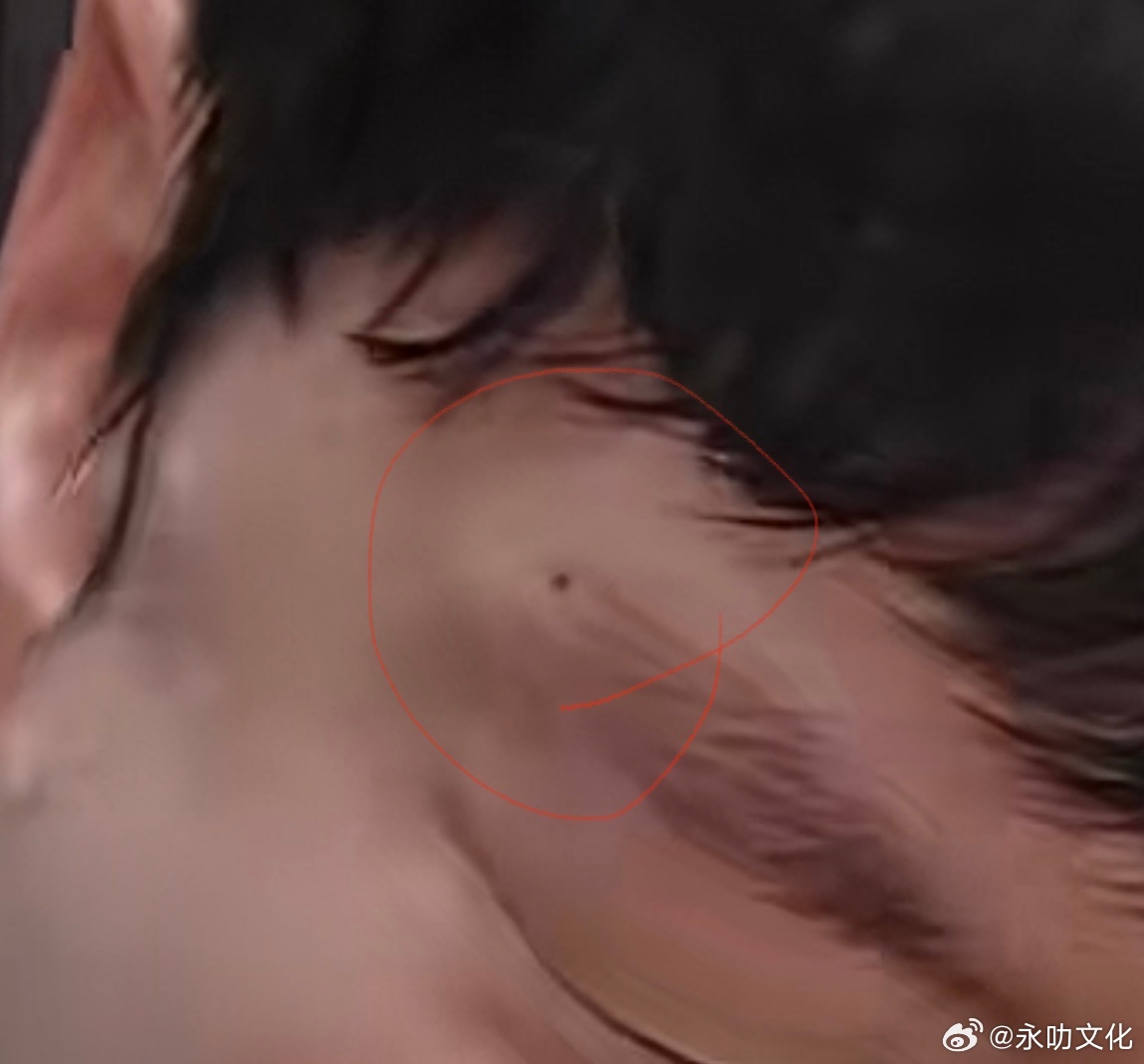 面相一则：如图，一颗黝黑且明显的痣对运势的影响=1-3颗小而浅的痣的影响。如图眉尾的痣，代表人缘、友谊、恋人。这个位置有痣，代表对他人的情感来的快，但是链接却不深，容易被情感伤害，比如一开始和这个人关系很好，但是很快就冷了，甚至有矛盾，然后渐行渐远。或者一开始贵人帮助你，后面就开始对你有损坏。恋人也是一样，一开始很亲密，后来矛盾会越来越多。如果眉尾散，那么还影响钱财，一开始钱财赚的稳步增加，但是后来越来越少，甚至破财。这种运势基本上要虚岁33以后慢慢减少坏的影响。面相小‬知识手相面相八字算命