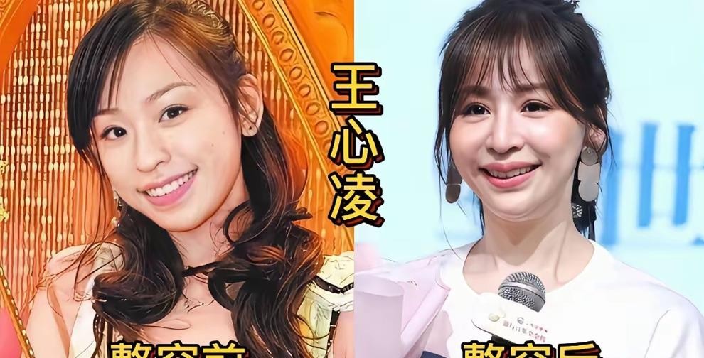 熊黛林直播时被网友追着问脸，她没躲，直接说医美谁没做过，有点条件想走捷径的都做过，自己肯定也做过。柳岩早几年就承认打过瘦脸针，后来怕影响拍戏表情就不打了。戚薇被说双眼皮贴的，回了一句我是割的怎么了。这几个人把事摊开之后，路人缘反而好了。可你看那些年年说纯天然的，被翻出旧照一次就被嘲一次。观众其实不反