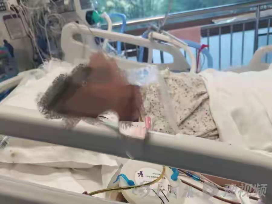 45岁产妇赵秀玲在山东淄博市周村区妇幼保健院剖宫产手术时，突发呼吸心跳骤停，经抢救后转院治疗，最终不幸离世。历经3年，淄博市医学会、山东省医学会、中华医学会先后作出三份不同的鉴定结论，从“不属于医疗事故”到“一级甲等医疗事故、医方承担轻微责任”，再到“一级甲等医疗事故、医方承担主要责任”。

赵秀玲