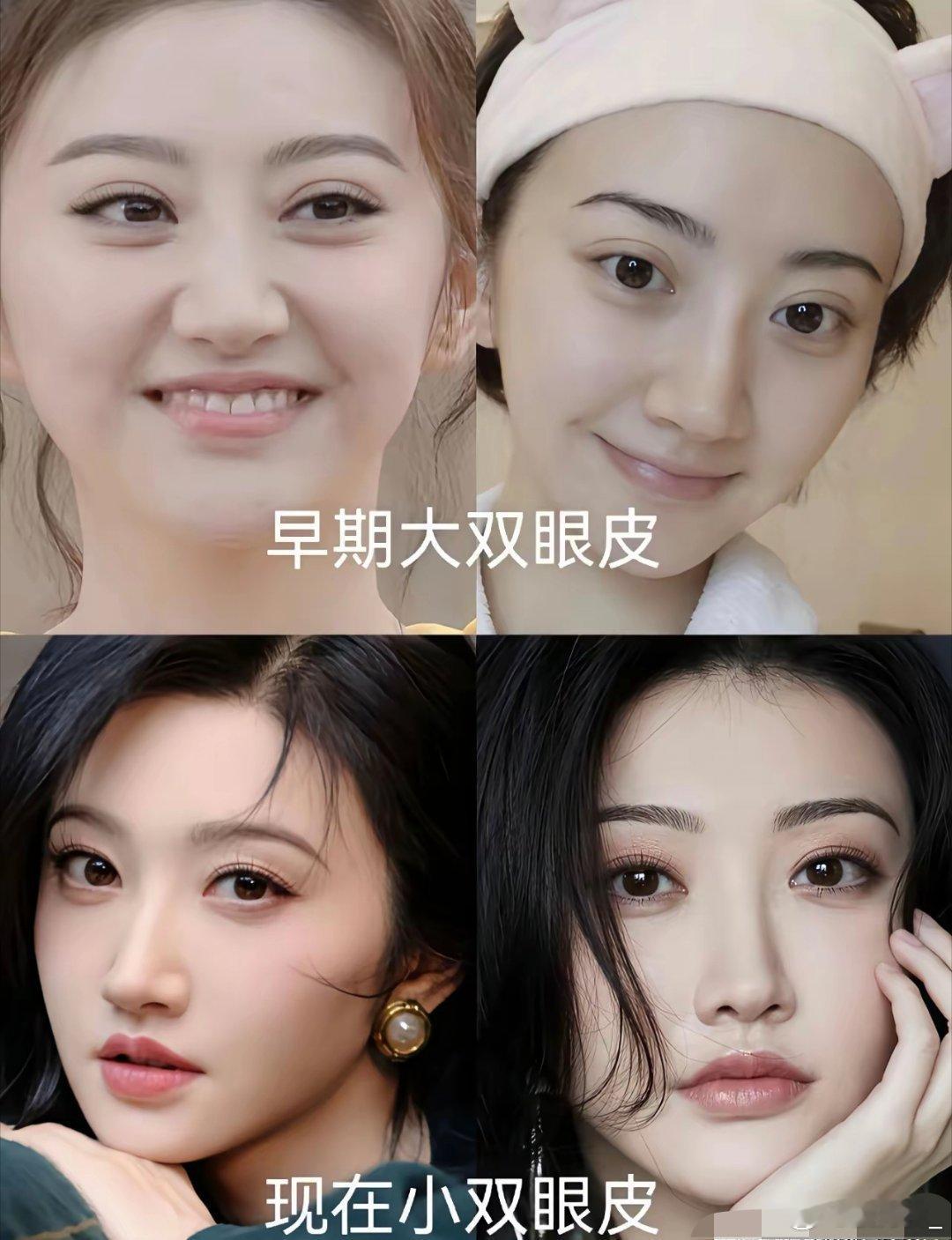 景甜早期伤心蛙的大双眼皮真心不好看 还好后面调回来了 ​