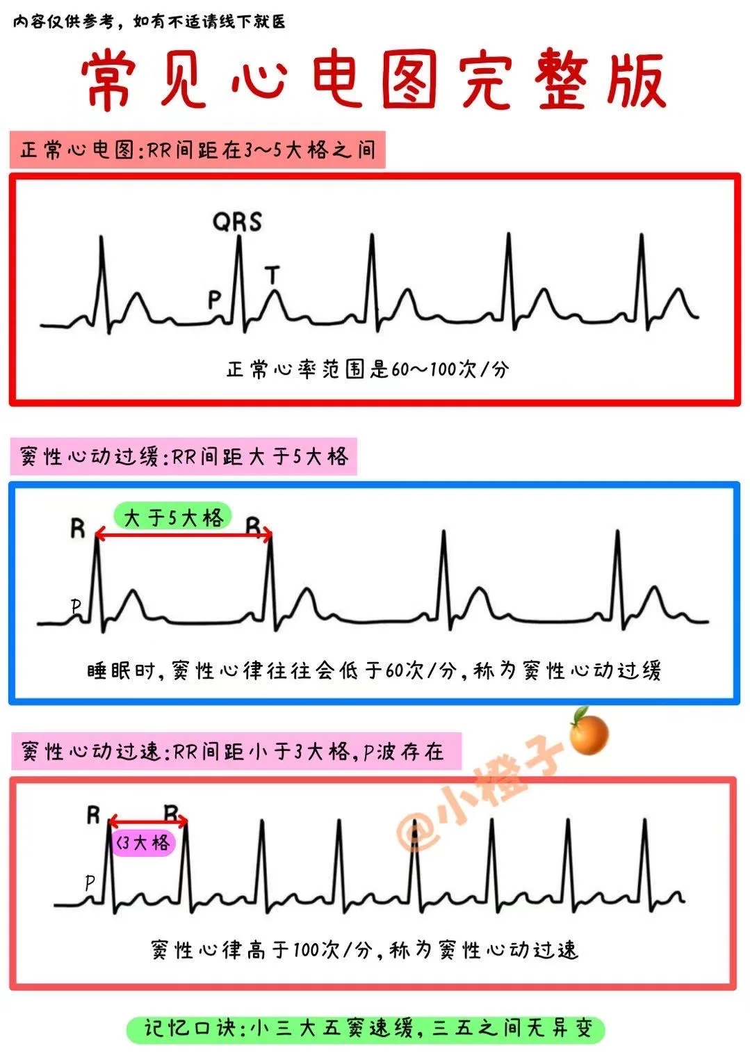 担心心脏问题❓房室传导阻滞心电图全解析✅