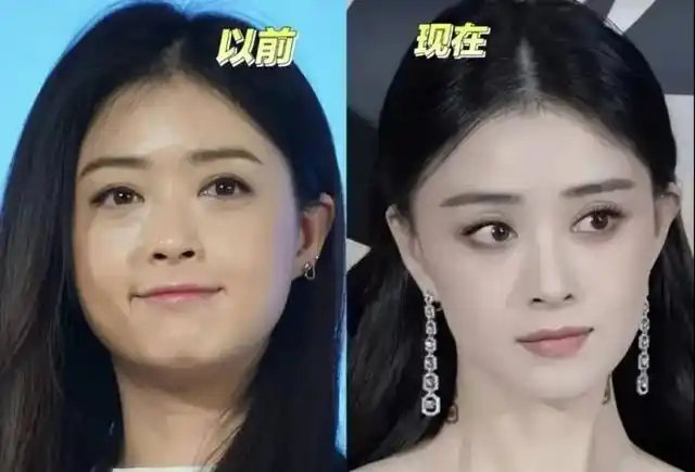 蒋欣在上海瘦成“巴掌脸”，白玉兰奖影后脸颧骨突起惹人心疼，这种以瘦为美的审美你真爱吗 ​