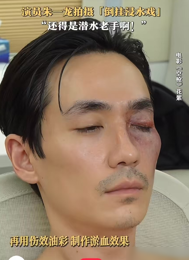 朱一龙拍《空枪》，高烧39度被倒吊着拍了半小时，放下来脸都是紫的，愣没吭一声。
这哥们拍《负负得正》，抱摔戏没护具，头直接砸地上，额头缝了三十多针，鼻梁也缝了四五针。拍《峰爆》，为了一秒钟的镜头，从十米高陡坡滚下来十七次，膝盖差点废了。拍《叛逆者》，爆破点太近把左耳震伤，为了演肺病，两天两夜不睡觉