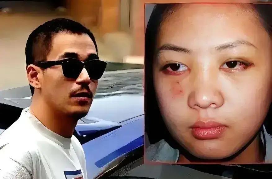 2003年，张国立的儿子张默，在中戏门口殴打女友童瑶，18岁的童瑶被打到跪地求饶：“歇10分钟再打吧！让我缓缓行吗？”没想到，张默接下来的举动，让她至今无法原谅。
童瑶坐在医院长椅上，等护士叫她的名字。脸上盖着冰袋，遮住了淤青，但遮不住周围人探寻的目光。她能感觉到那些视线在她身上短暂停留，又迅速移开