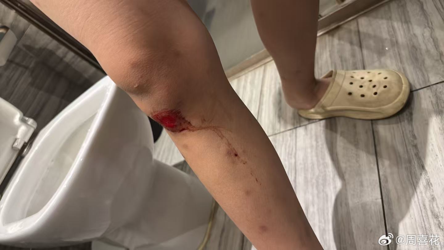 #生活手记#
陪伴孩子，每一天都是在学习
      好好的一个假期，带他俩跟朋友们一起外出游玩，出发不久，车内的密闭空间加上内循环有些尘，他的过敏反应就越来越严重了，喷嚏停不下来，抽纸都抽不赢的状态，一路上都在偷瞄着路边有没有药店，心里就生出不快，明明是过敏体质，出门都提醒了带上自己的必 ​