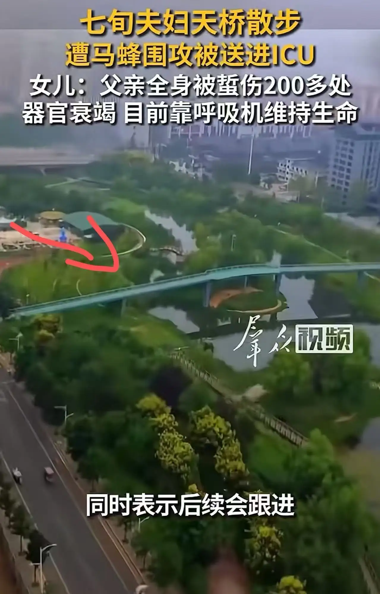 “谁来担责？”70多岁大爷牵着老伴出门遛弯，经过人行天桥时，突然遭马蜂群围攻，双双被送进ICU！女儿：“父亲全身被蜇伤200多处，各个器官已基本衰竭，两人尚未脱离生命危险，没有一个管理部门站出来承担责任
七十多岁的老人，牵着手过天桥，本来是晚年最普通的浪漫。结果蜂群一涌，老伴倒下去那一刻，大爷第一反
